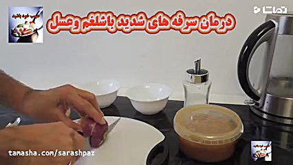 درمان سرفه شدید درمان جای جوش
