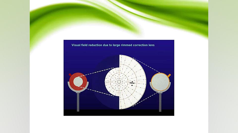 تکنیکهای پریمتری ساندرا بولاک