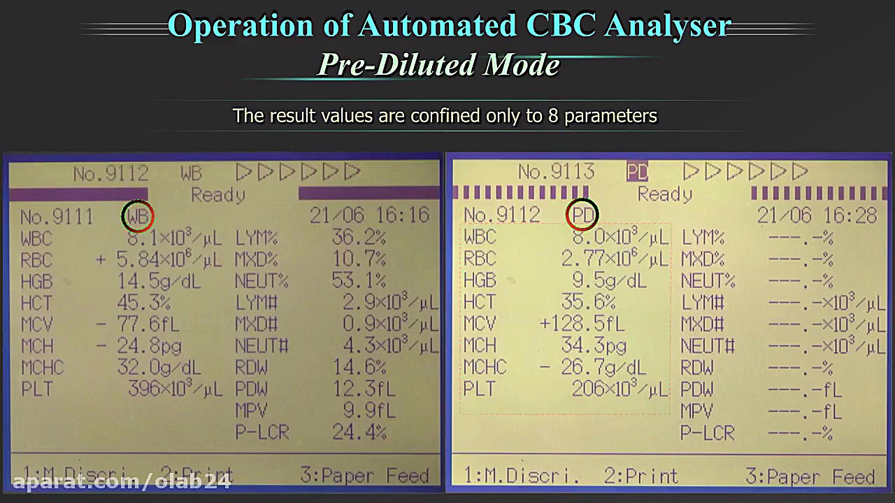 CBC Analyzer- قسمت 2: راه اندازی و عملکرد دستگاه CBC آنالایزر دندان پیش