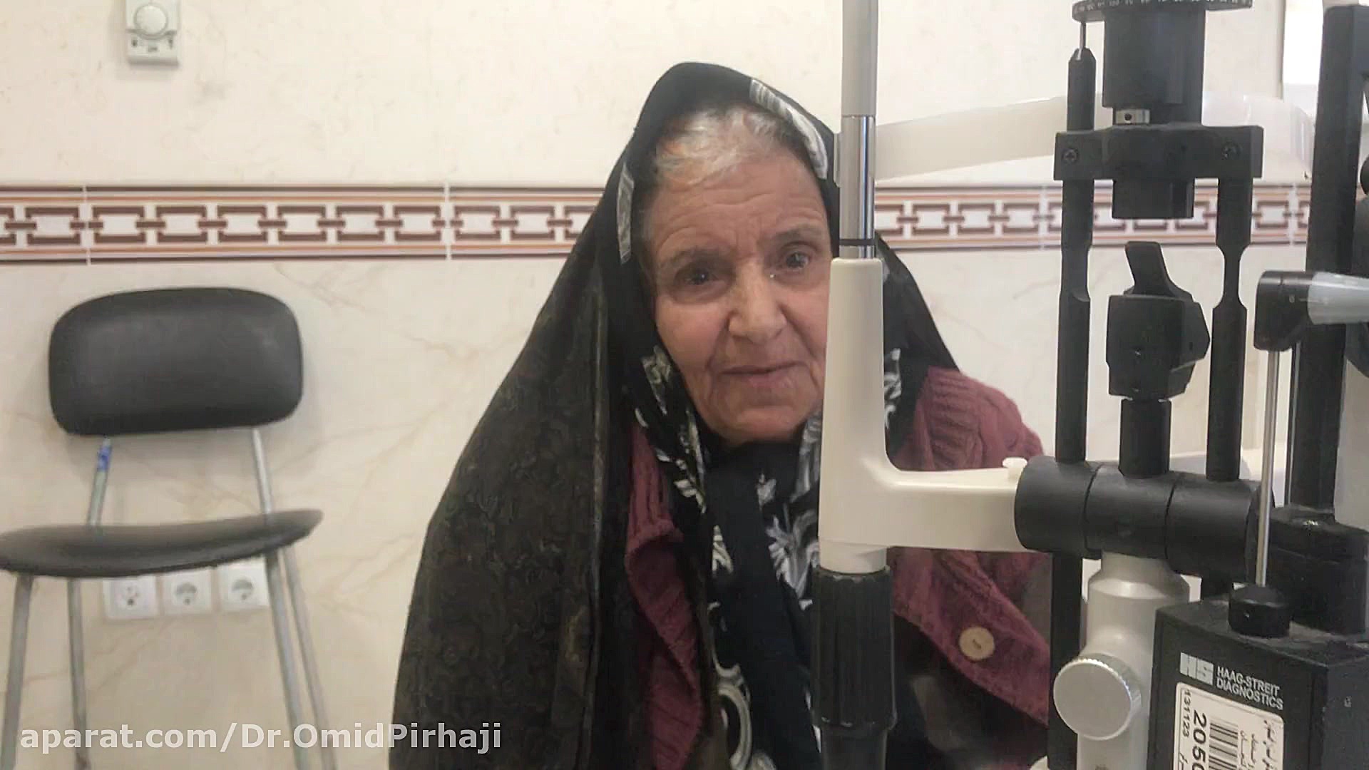 عمل جراحی آب مروارید (کاتاراکت) توسط دکتر امید پیرحاجی درمان جای جوش
