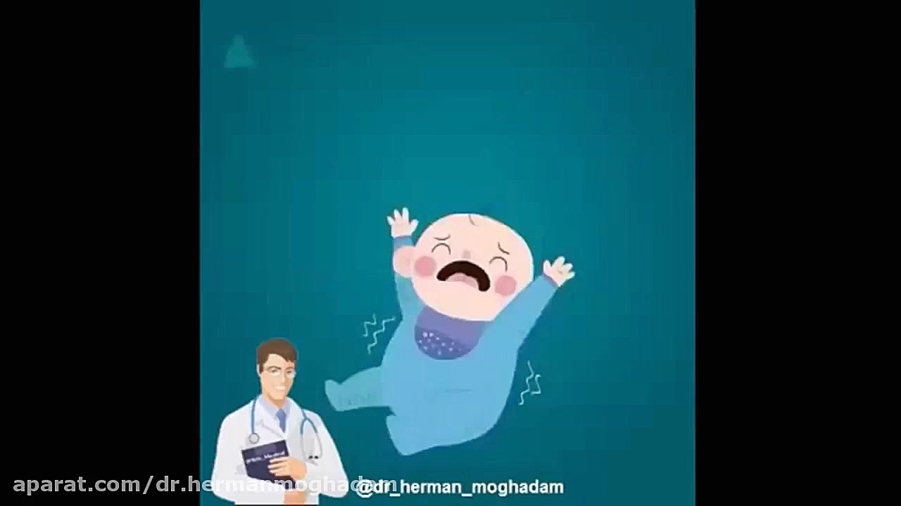 ماساژ ساده برای کودکی که قلج دارد کاشت ریش