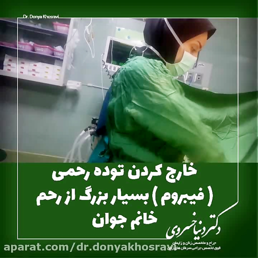 خارج کردن توده رحمی بسیار بزرگ از رحم خانم جوان