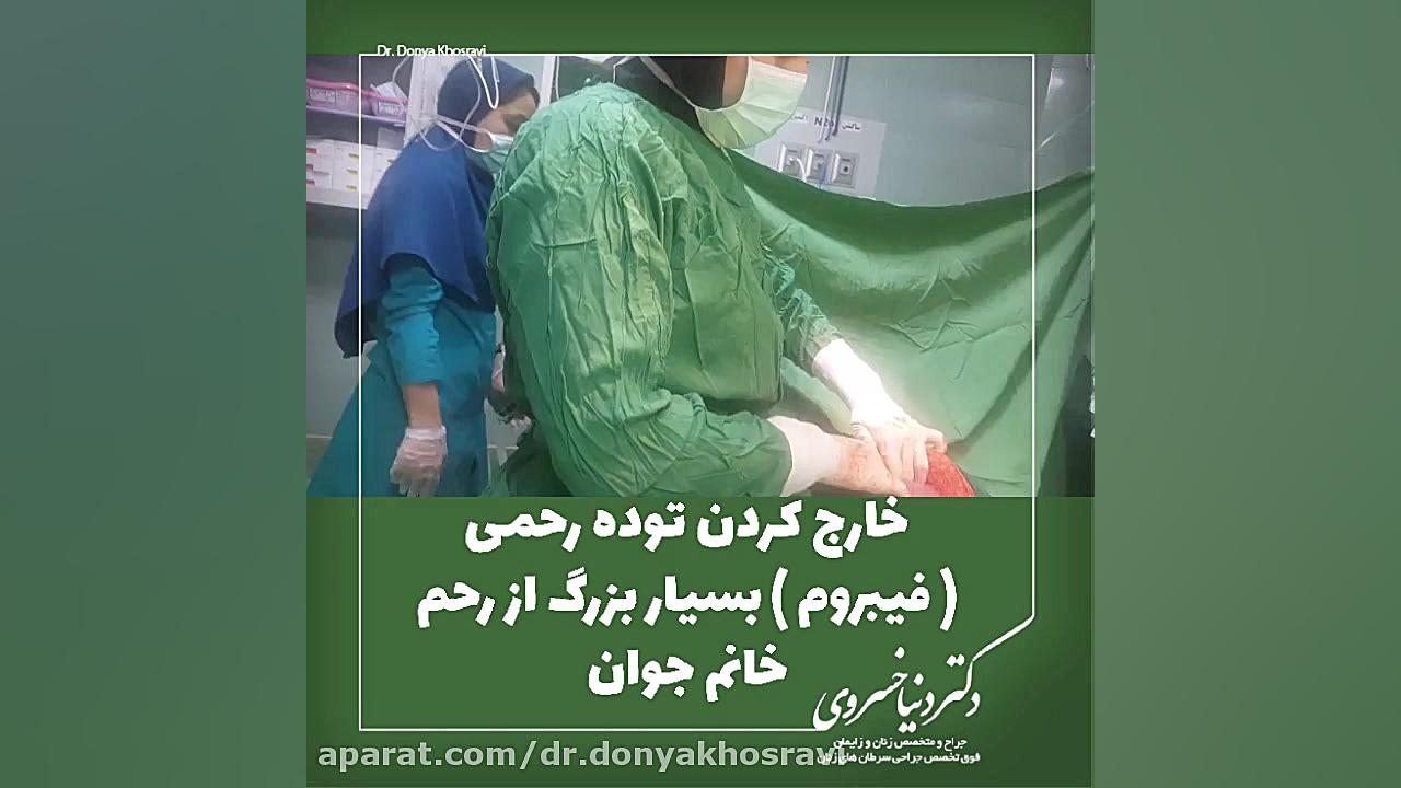 خارج کردن توده رحمی بسیار بزرگ از رحم خانم جوان دکتر دنیا خسروی