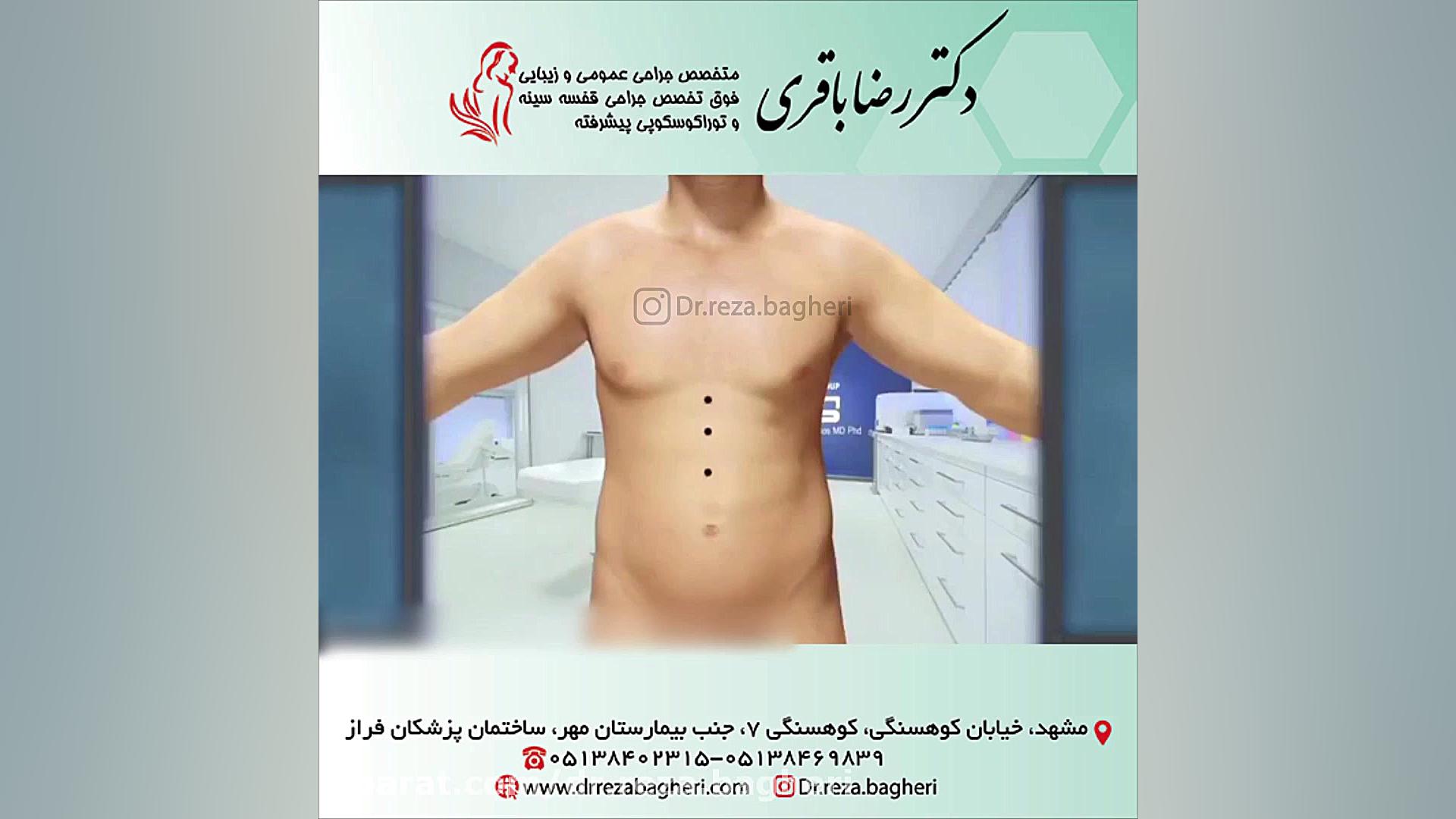 پیکرتراشی دکتر رضا باقری جراح سینه در مشهد