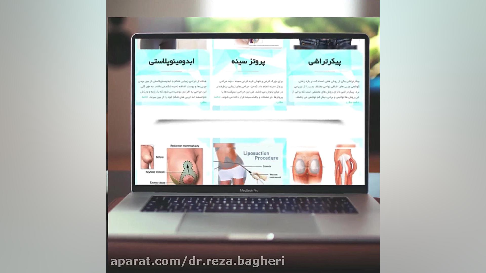 سایت دکتر رضا باقری ، جراح سینه مشهد دکتر رضا باقری جراح سینه در مشهد
