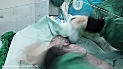 لحظه ی به دنیا آمدن نوزاد در ب...