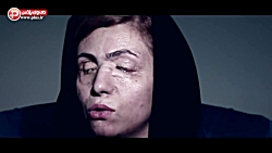 اسیدپاشی وحشیانه روی عروس ایرا...