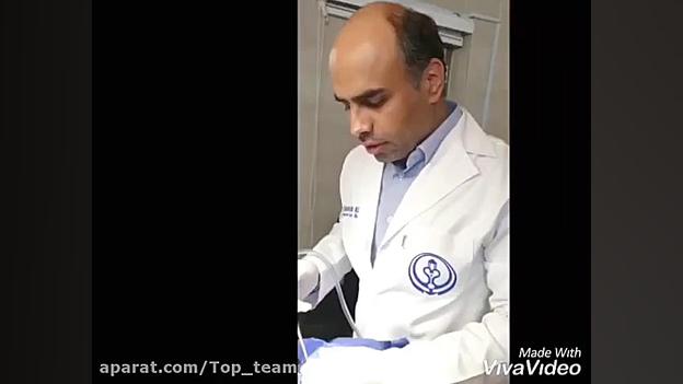 رفع #غبغب_از بین بردن #چربی_زیر_گردن_#لیپوساکشن_غبغب تزریق چربی