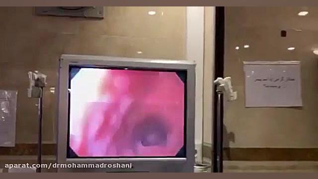 اندوسکوپی زیبایی پوست