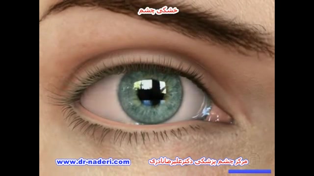 خشکی چشم - مرکز چشم پزشکی دکتر علیرضا نادری مرکز چشم پزشکی دکتر علیرضا نادری www.dr-naderi.com