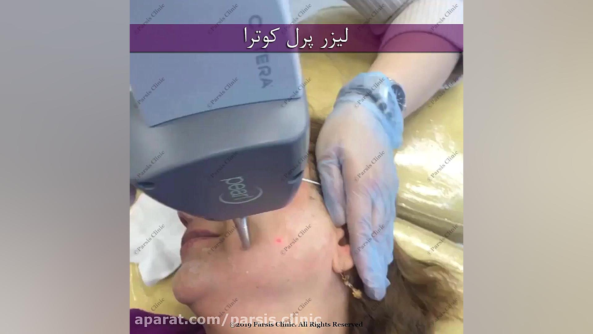لیزر جوانسازی پرل کلینیک تخصصی پوست،زیبایی،لیزر و کاشت مو پارسیس
