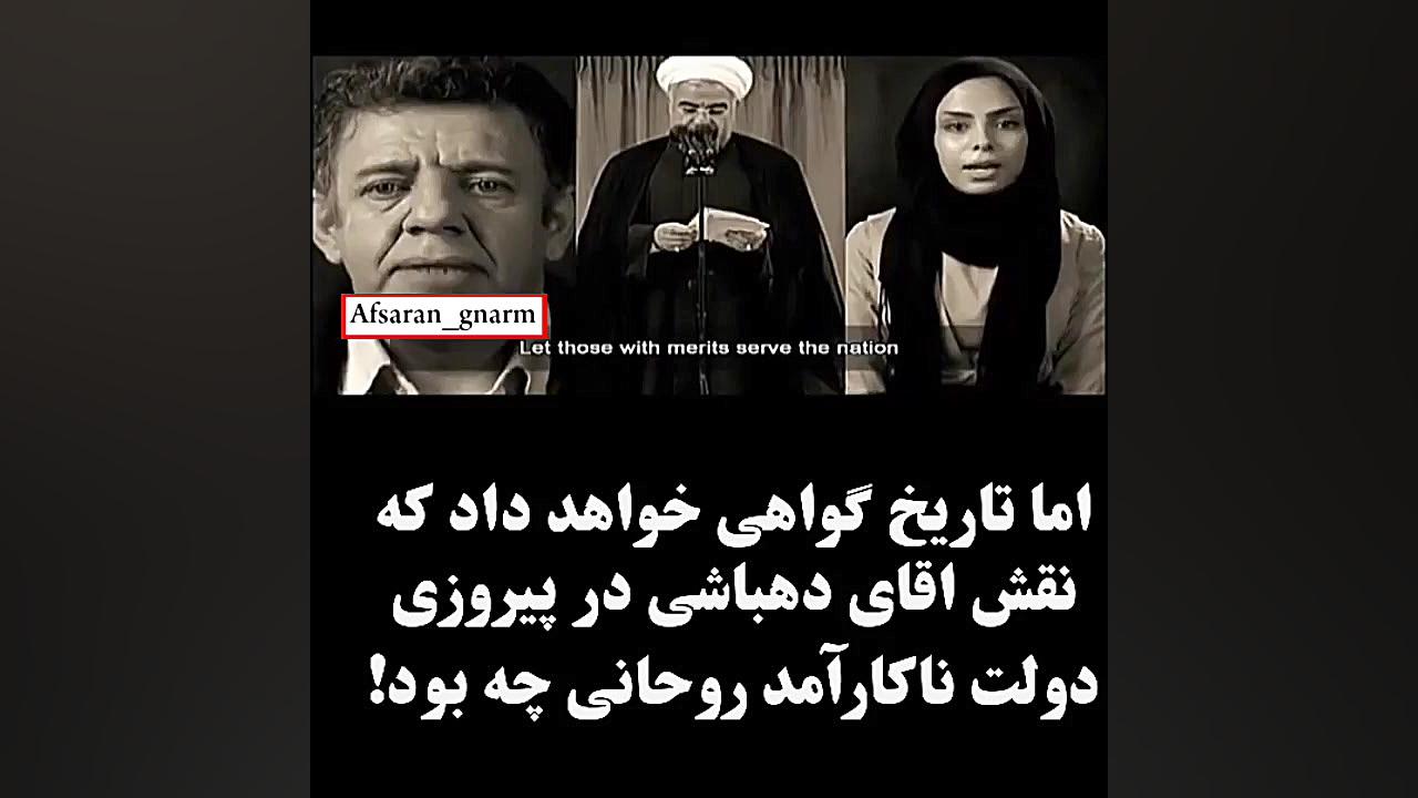 پاسخ به هذیان گویی حسین دهباشی کاشت مو