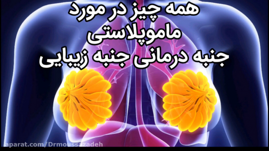 ماموپلاستی عمل زیبایی یا عمل درمانی ؟! لیپوماتیک