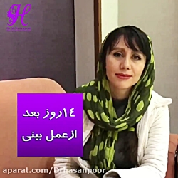 رضایت از جراحی بینی دکتر حسن پ...