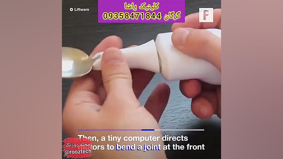 کلینیک تخصصی اختلال بلع در گرگان_حنیف امانیان هایفوتراپی