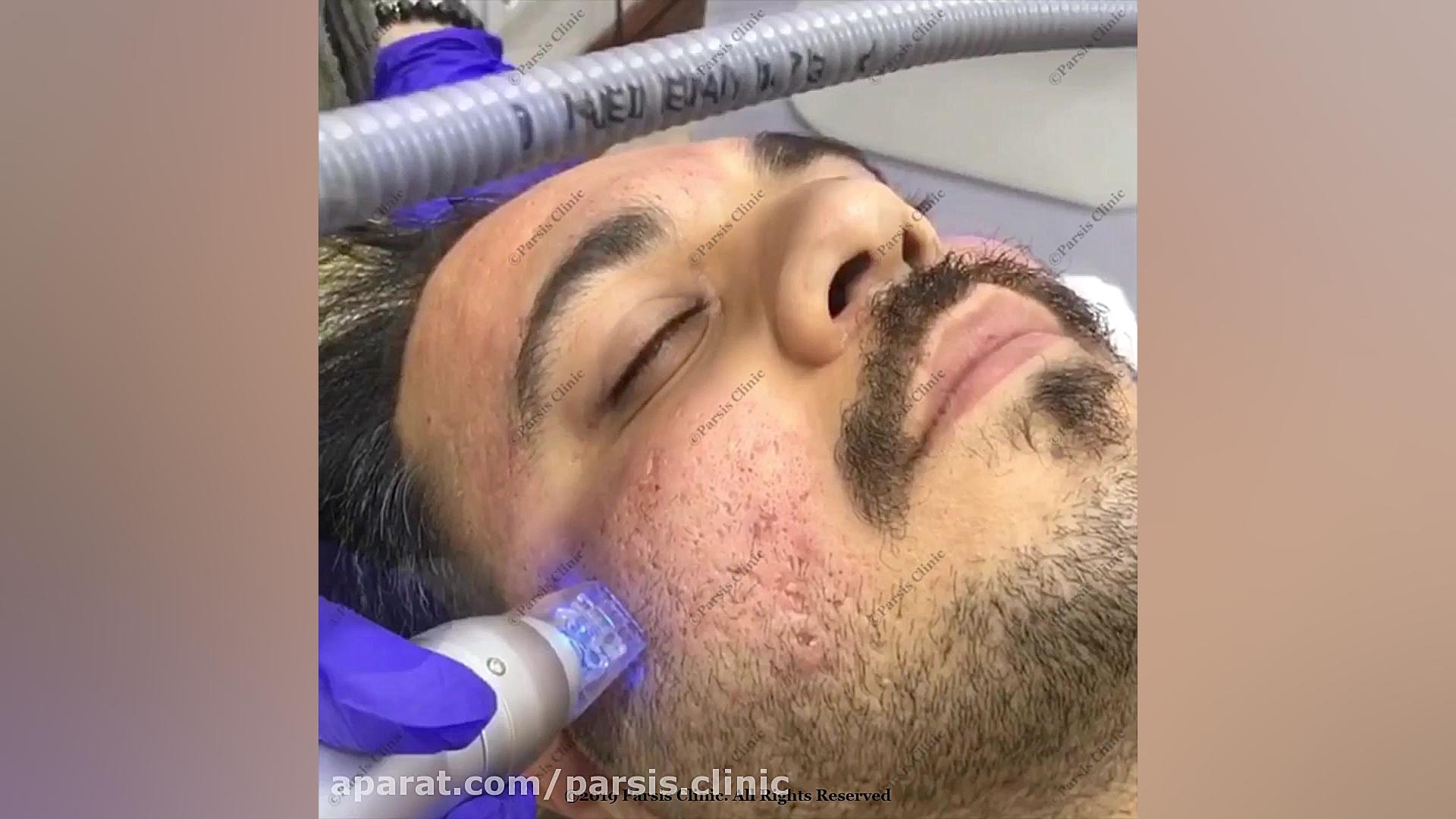 ار اف فرکشنال اسکارلت کلینیک تخصصی پوست،زیبایی،لیزر و کاشت مو پارسیس