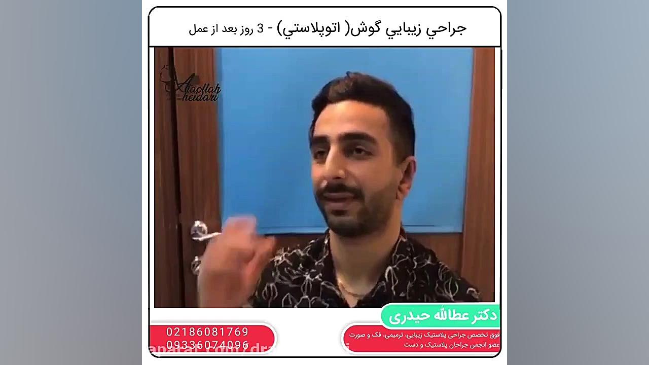 جراحی زیبایی گوش (اتوپلاستی) بیماری کلوتزوکس