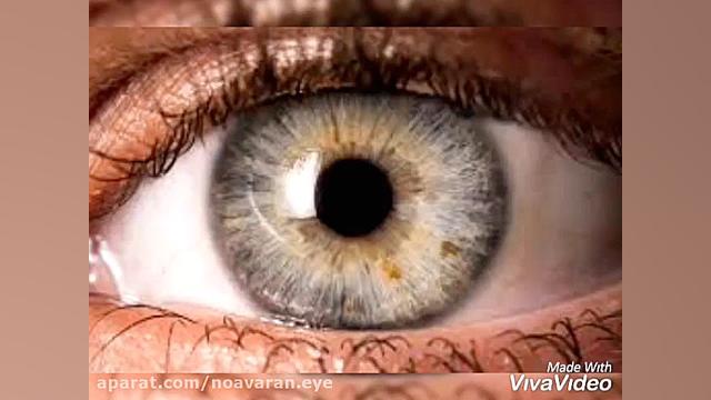 بیماری اب سیاه ( گلوکم) در چه سنی بروز میکند؟ کلینیک مو