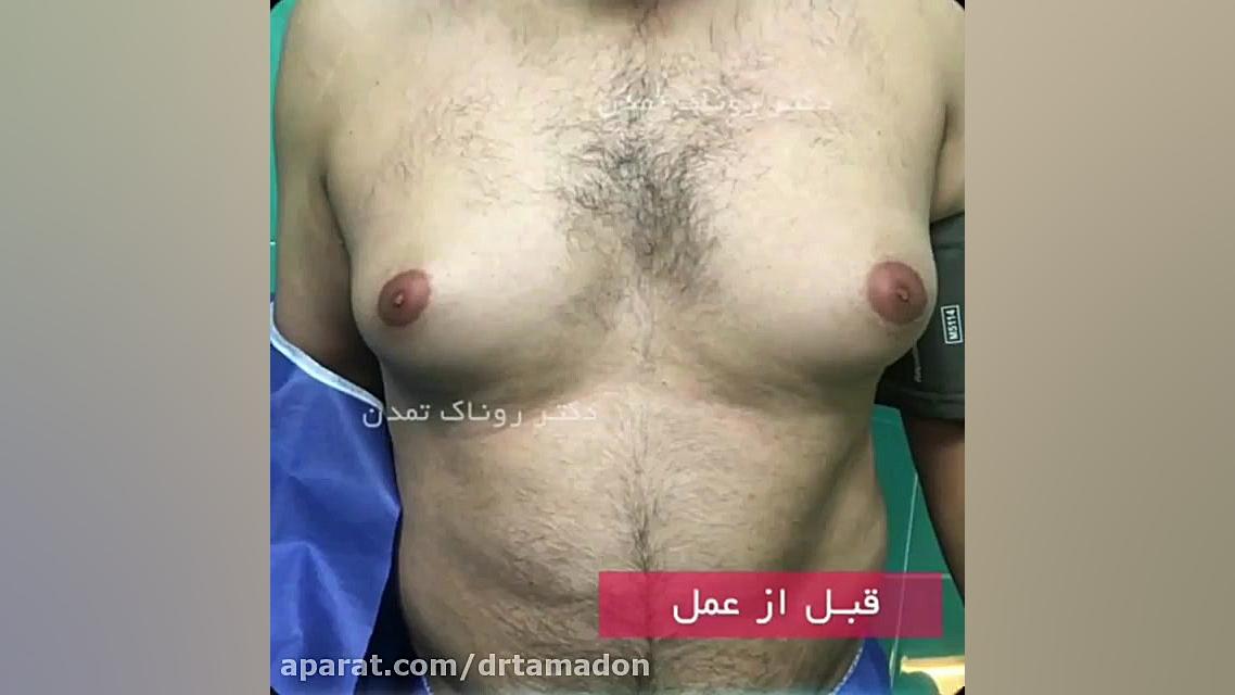 فیلم واقعی جراحی سینه در مردان کلینیک دندانپزشکی