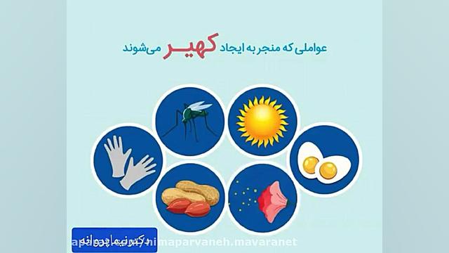 عواملی که منجر به ایجاد کهیر می شود کاور آهنگ