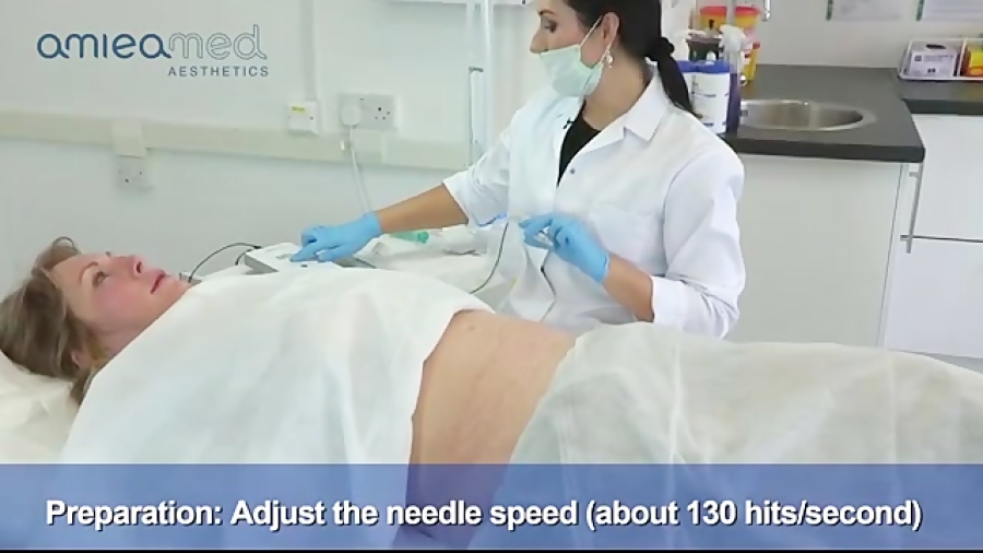 ترمیم اسکار جراحی با دستگاه میکرونیدلینگ amieamed بیماری کلوتزوکس