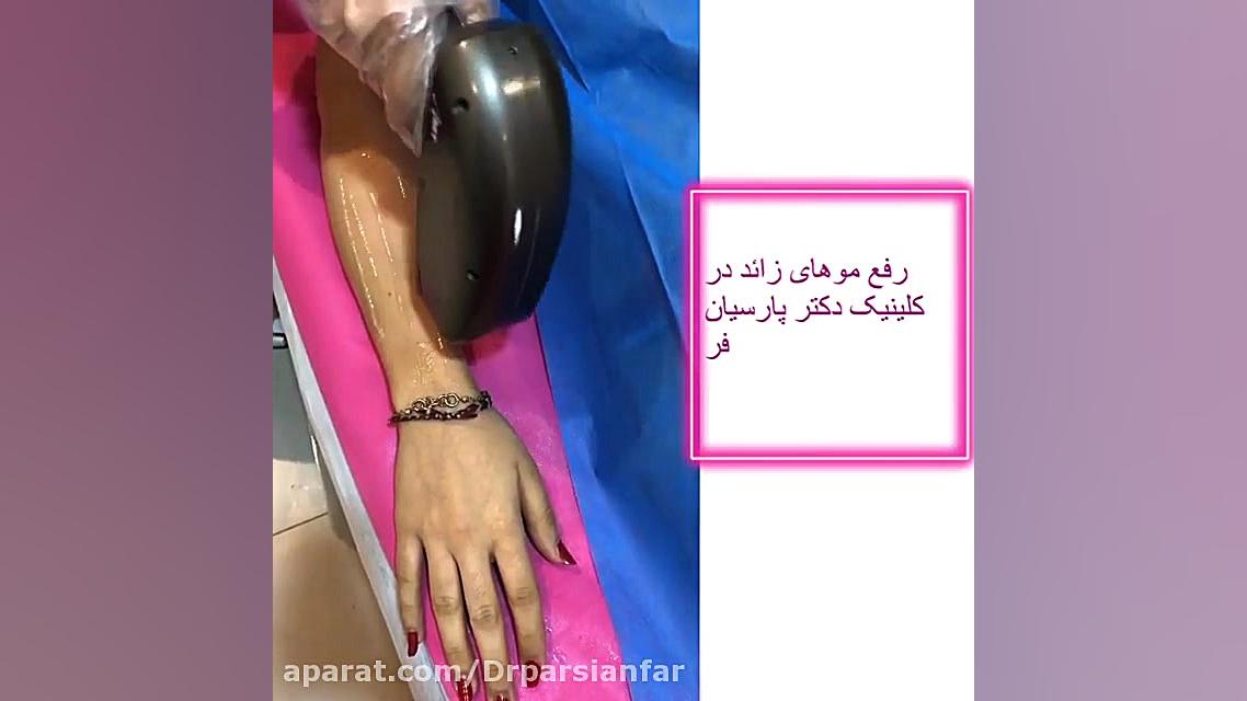 لیزر موهای زائد لیفت صورت