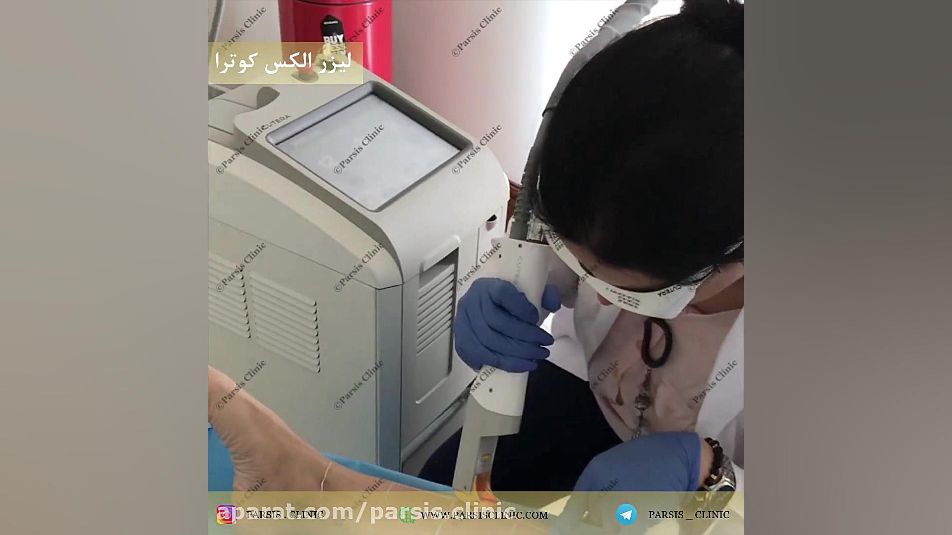 لیزر الکس سرد کوترا - پیشترفته ترین لیزر موهای زائد ساخت امریکا کلینیک تخصصی پوست،زیبایی،لیزر و کاشت مو پارسیس