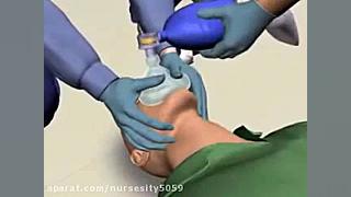 فیلم آموزشی تنفس مصنوعی زمان95ثانیه