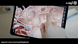 ویدیو انیمیشنی از نحوه عملکرد...