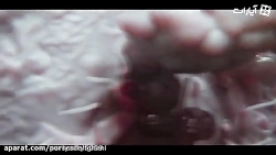 تأثیر کرونا بر روی ریه و علائم...