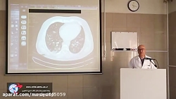 توضیحات استاد رادیولوژی دانشگا...