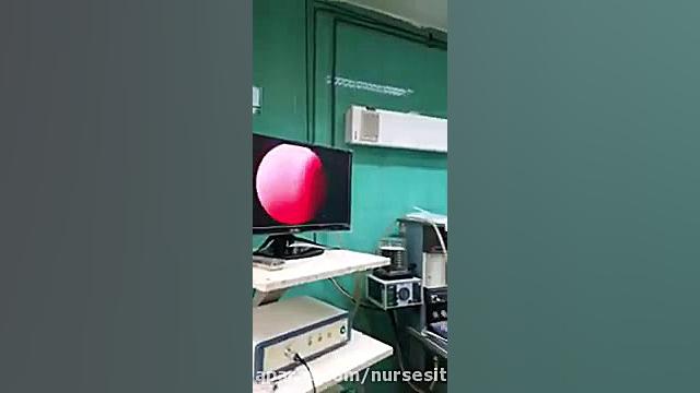 فیلم جراحی سینوزیت بینی کلینیک لیزر