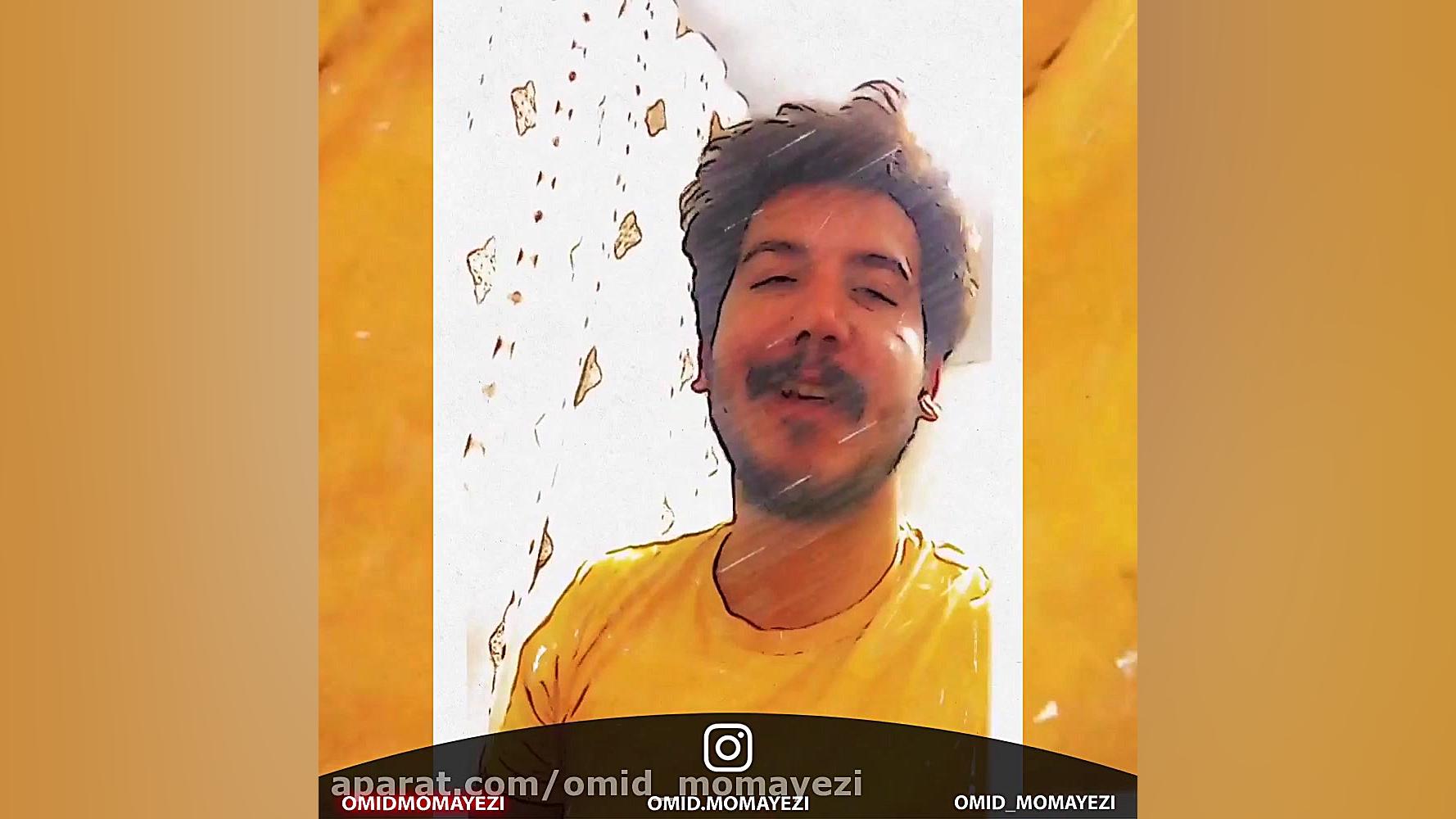 با ماشینت پز میدی؟ امید ممیزی کاشت ریش
