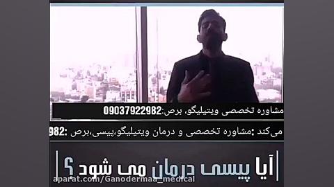 چطوری پیسی درمان میشه روکش دندان