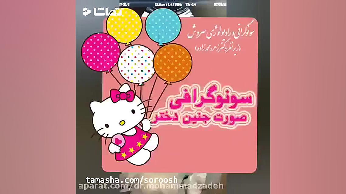 فیلم سونوگرافی صورت جنین دختر ابی
