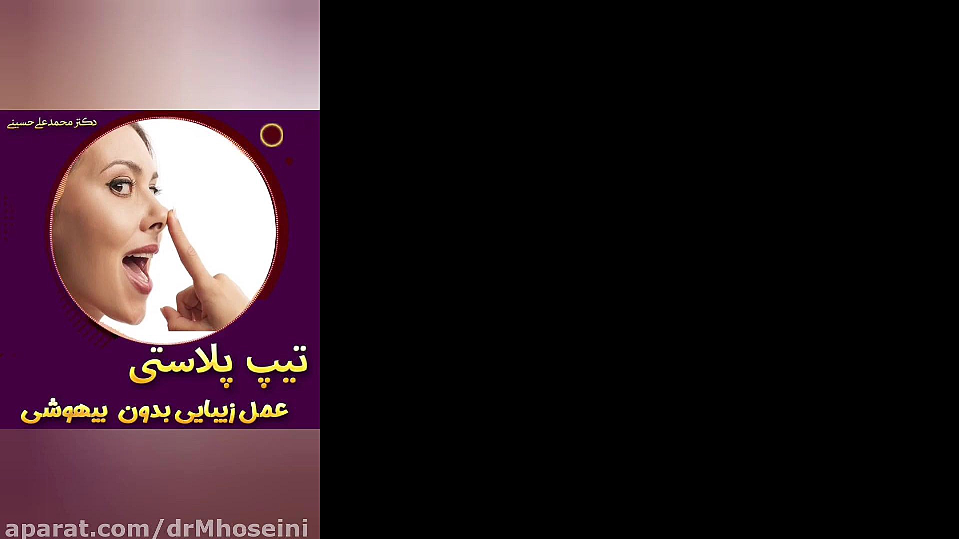 تیپ پلاستی بدون عمل و بیهوشی در اهواز کاشت ریش
