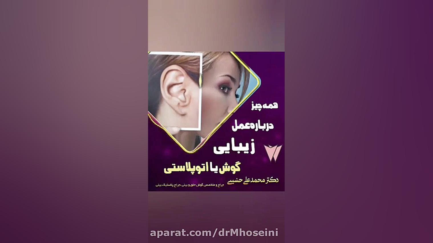 همه چیز درخصوص جراحی زیبایی گوش یااتوپلاستی آزمون سنجش اسید بیلی‌روبین غیرمستقیم