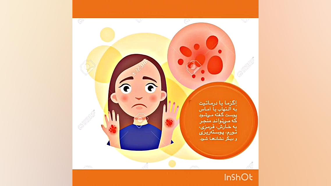 درمان اگزما هوش مصنوعی ترند