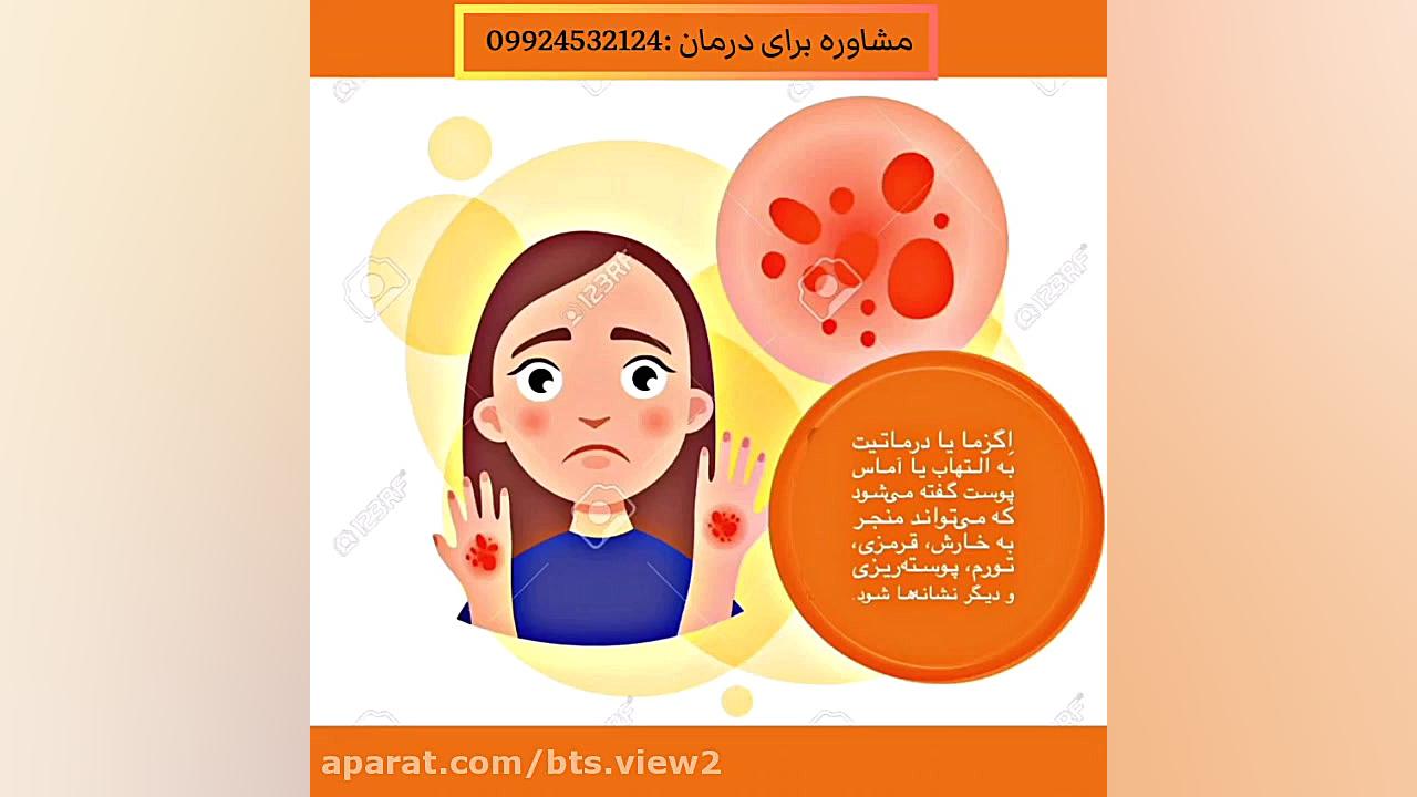 اگزما چیست و چگونه درمان می‌شود؟ جراحی فک