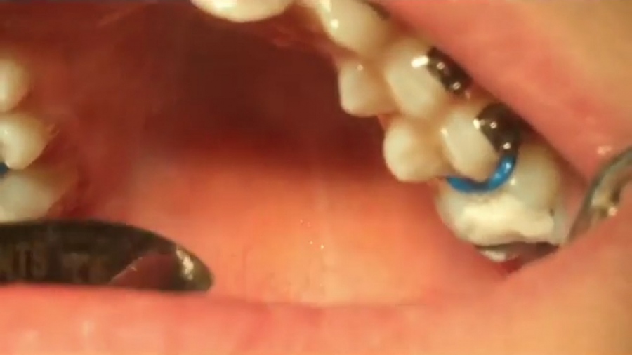 معرفی بایت ریزر دکتر برهمن سبزواری - متخصص ارتودنسی - مشهد