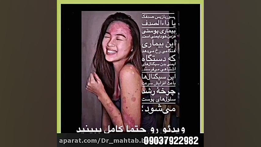 اگر پسوریازیس داری از ویروس جدید بترس احمدرضا عابدزاده