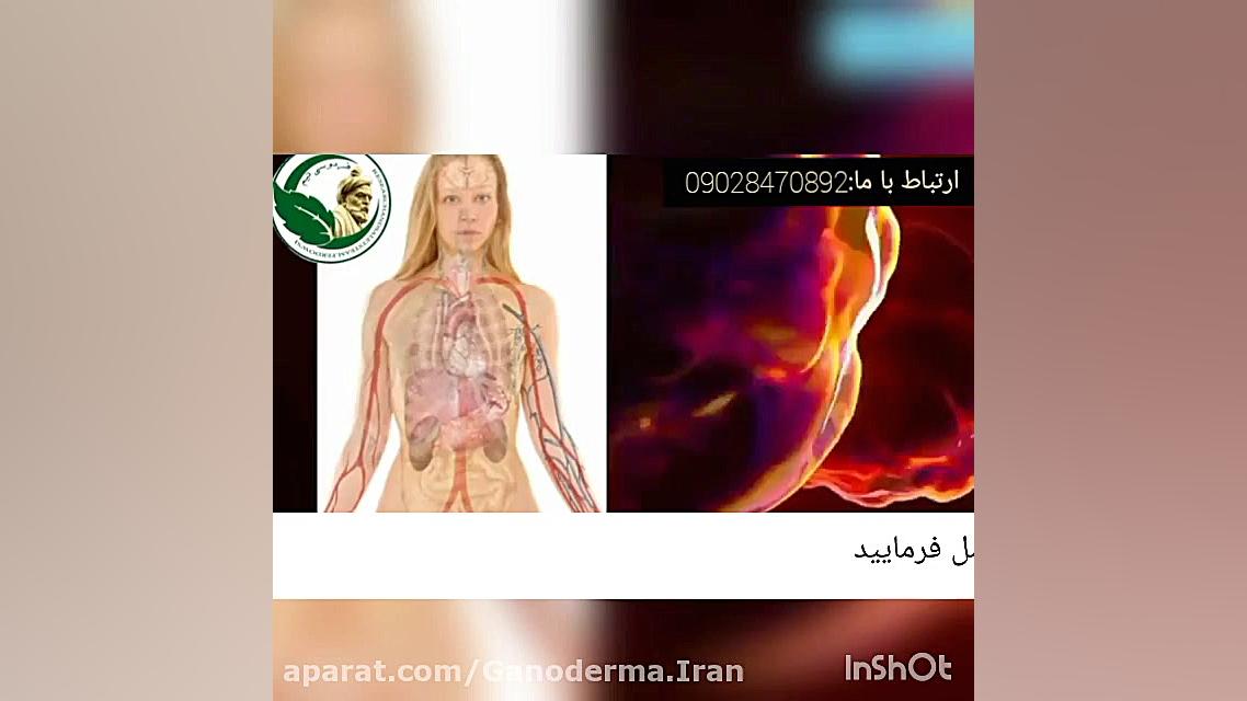 آیا عوارض بیماری ام اس را میدانید؟؟ دکتر پوست