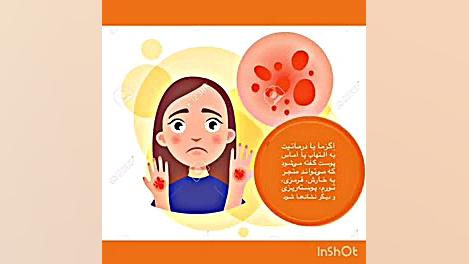 فوری فوری بیمارانی که التهابات پوستی دارند حتما ببینند ترقه پران