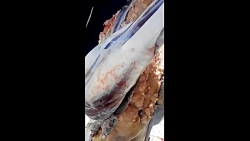 چربی های شترمرغ09125813530دنیا...