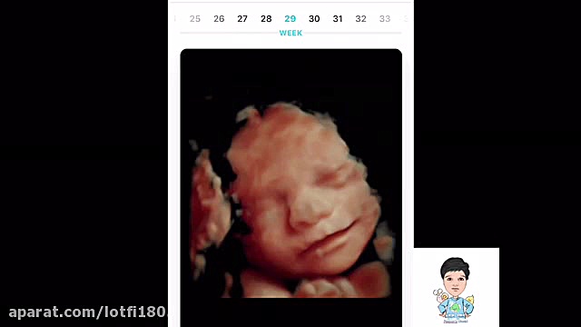 تصاویر باورنکردنی از اسکن سه بعدی هفته به هفته جنین دیوید بکهام