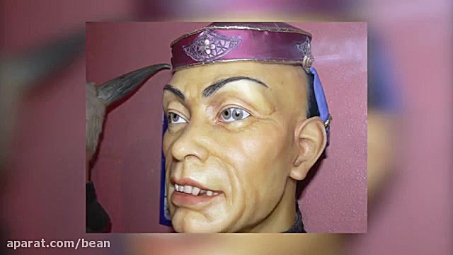 عجیب ترین چشم های جهان 1 اتوپلاستی