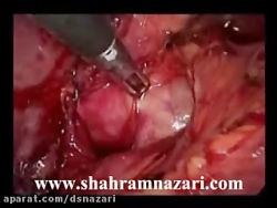 گزارش مصور یک مورد کله سیستکتو...