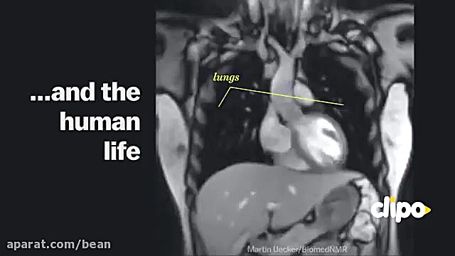 زندگی از دریچه دستگاه MRI حلزون توربو