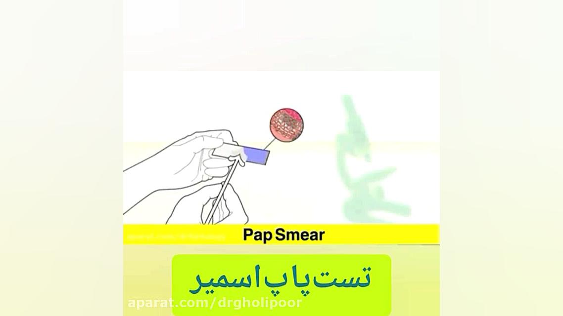 تست پاپ اسمیر دندانپزشکی کودکان