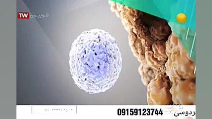 روماتیسم مفصلی چیست و آیا درمانی برای آن وجود دارد؟ عصب‌کشی